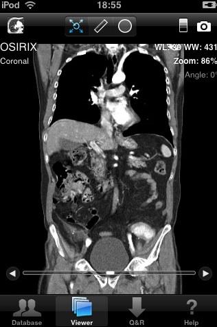 Osirix: visor imágenes DICOM